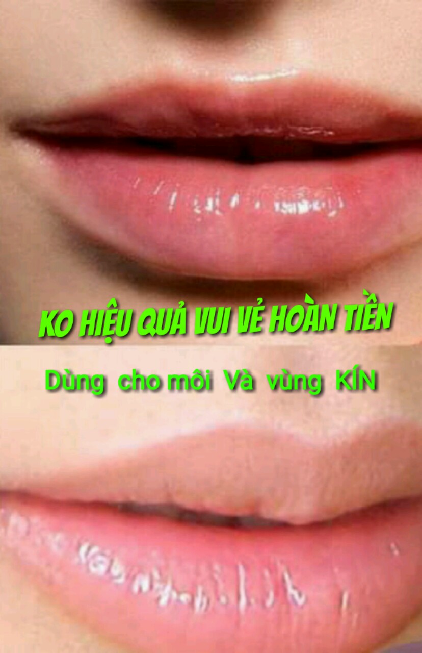 Mặt  nạ ủ dưỡng ẩm thâm  môi