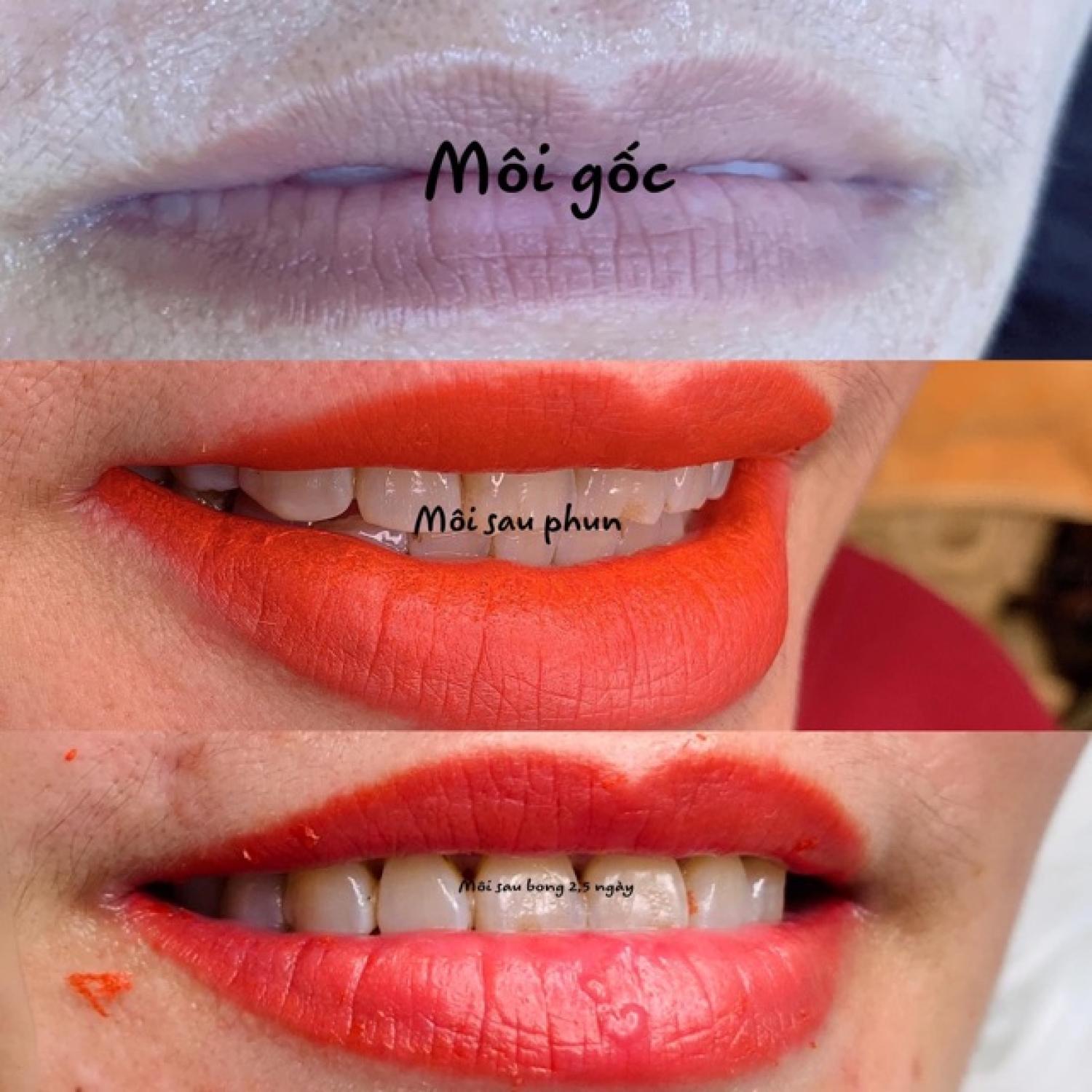 MỰC MỸ BONG ĐẬM HOA TÍT PHUN XĂM