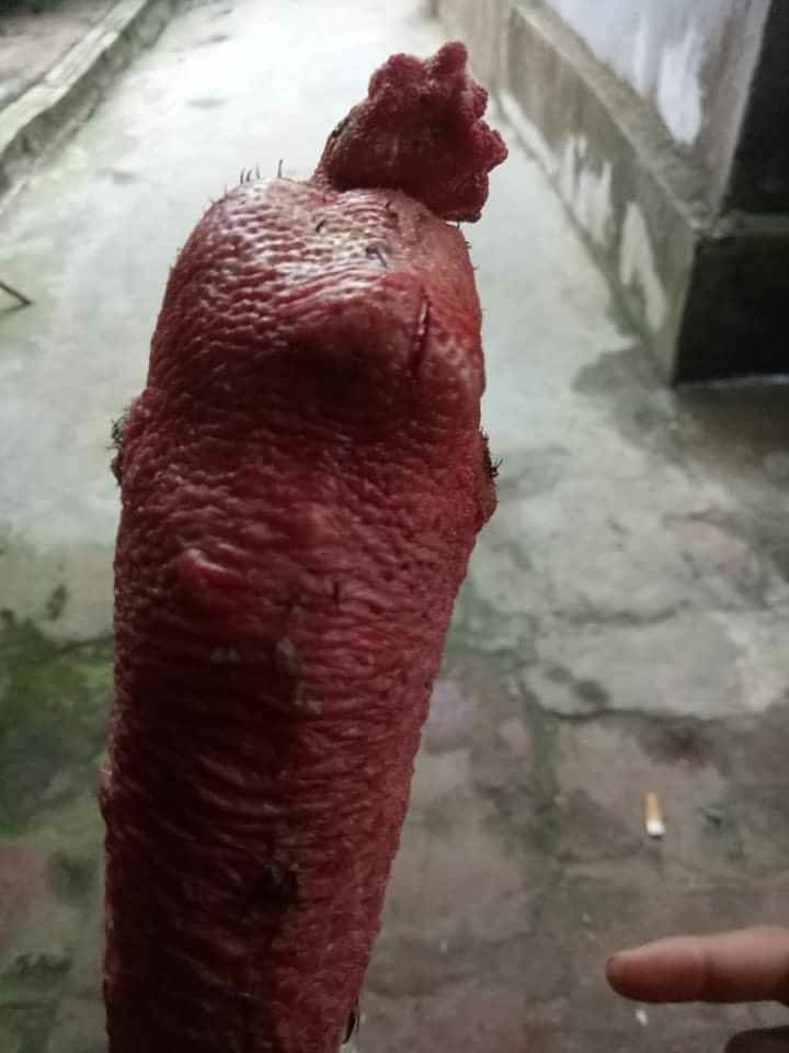 CAO TAN ĐÒN CHIẾN KÊ