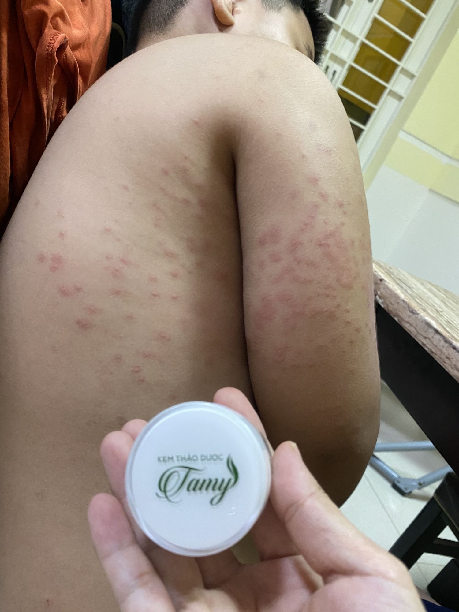 Kem thảo dược Tamy