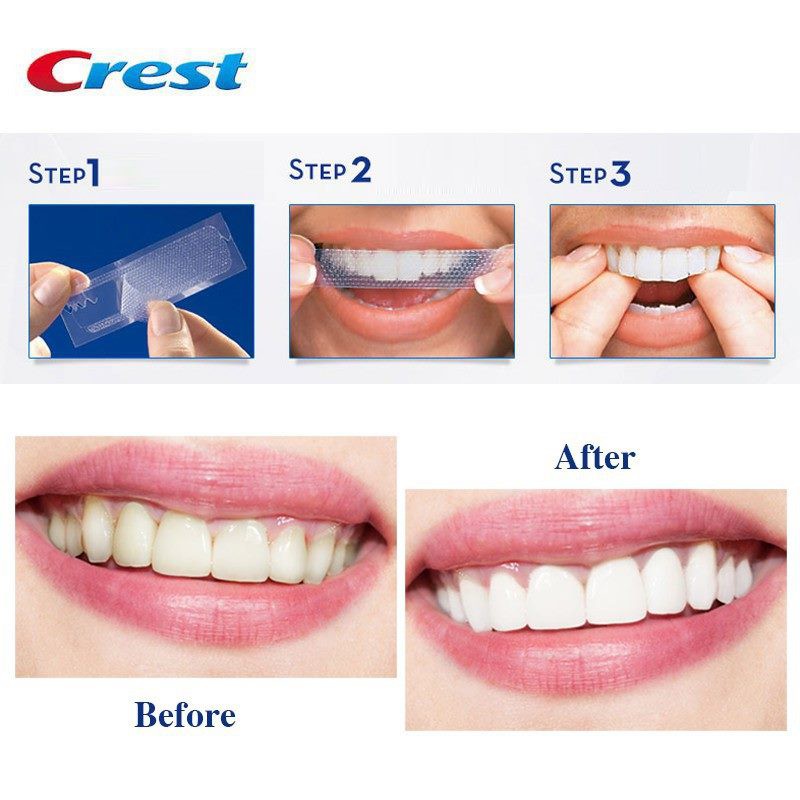 [CHÍNH HÃNG ĐỦ LOẠI] 1 GÓI LẺ - Miếng dán trắng răng Crest 3D White - Mỹ (Professional Effects/ Supreme Flexfit/ Glamorous/ 1 hour)