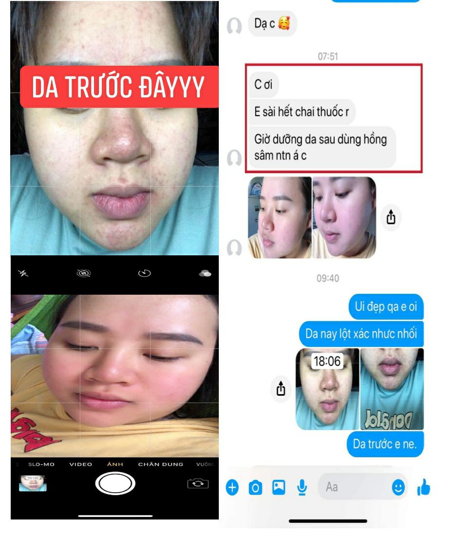 HỒNG SÂM TÁI TẠO DA ( Chính Hãng Ngọc Ngân 100%)