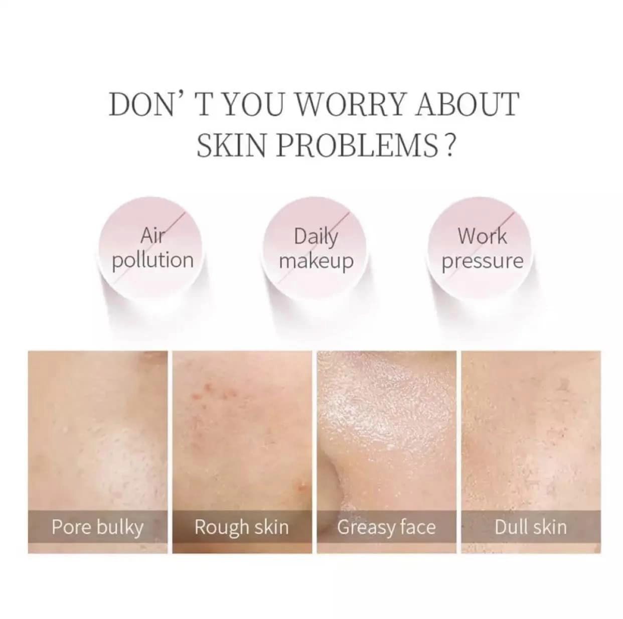 Mặt Nạ Bùn Dạng Lăn Heyxi Mask Stick