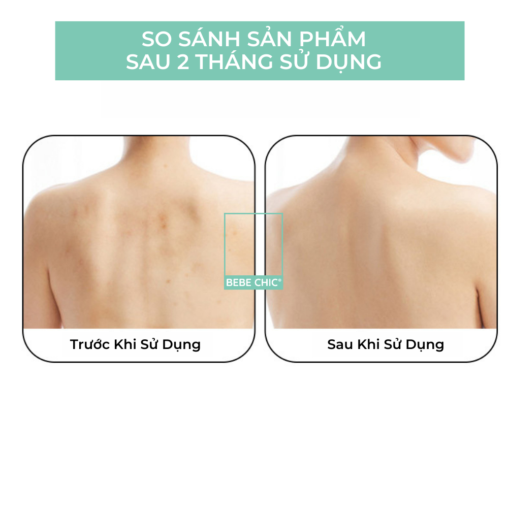 Găng Tay Tẩy Da Chết Làm Sạch Da Cao Cấp BEBECHIC