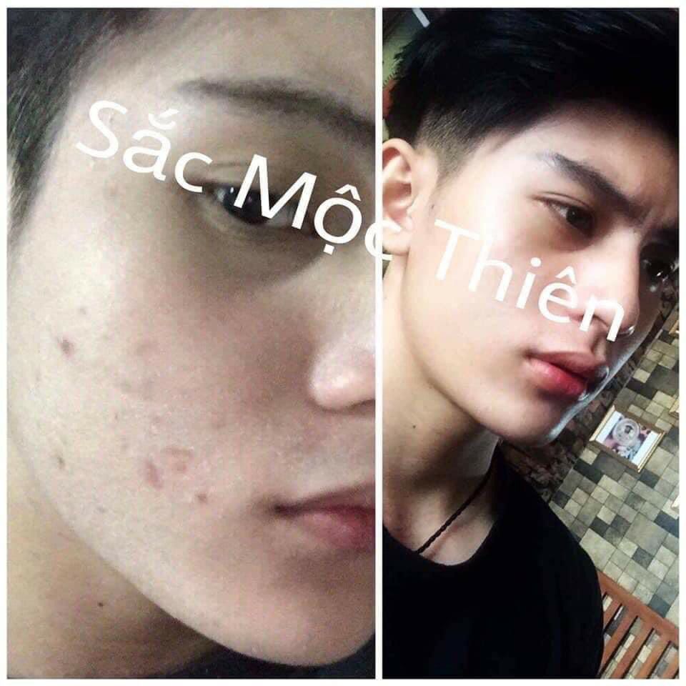 Tinh Chất Dưỡng Da Sắc Mộc Thiên