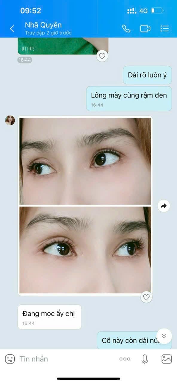 [HOT] Dưỡng mi dưỡng mày Celi-dưỡng chất cực mạnh mi cong dài