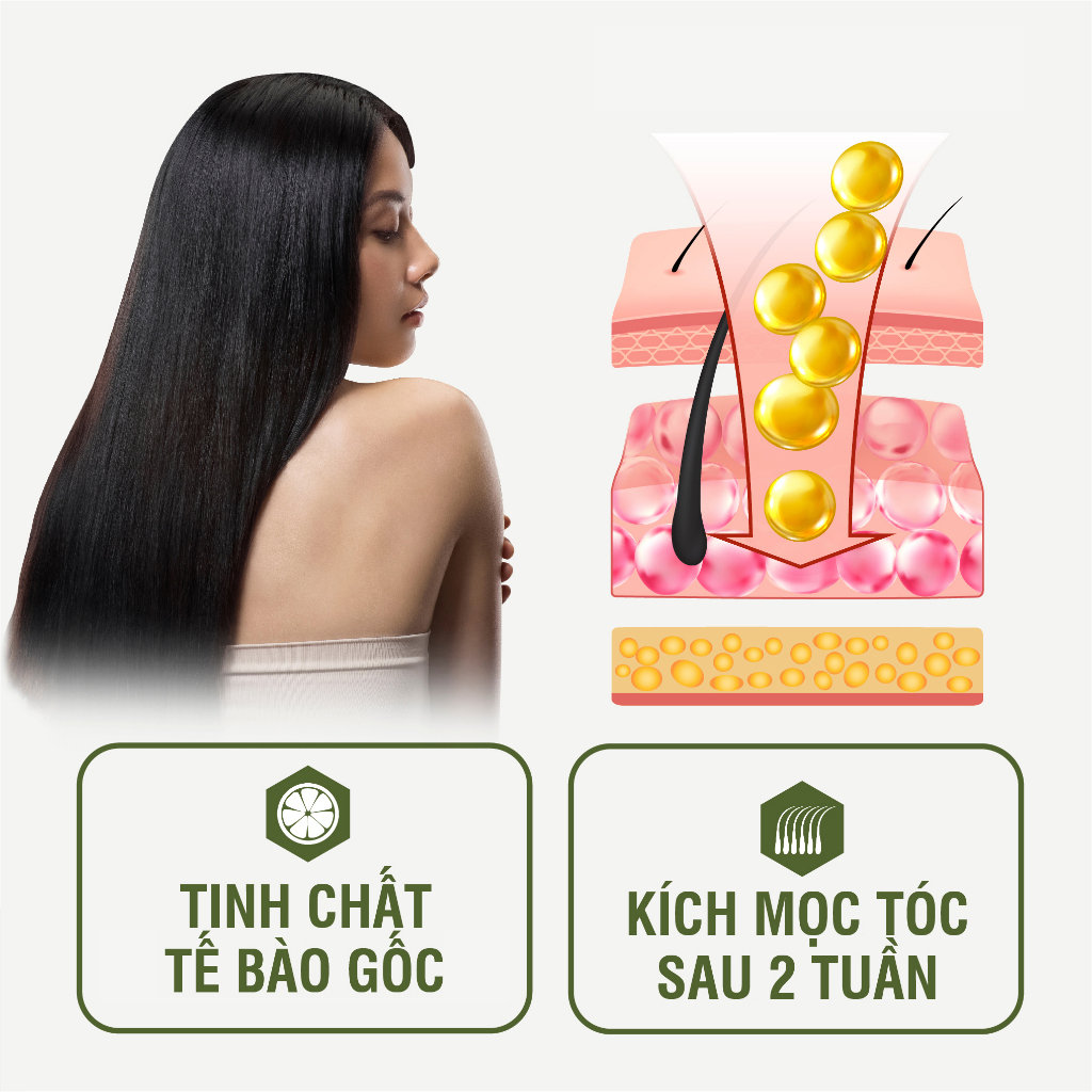 Tinh chất Sato chấm hói mọc tóc giảm rụng tóc 30ml Nhật Bản