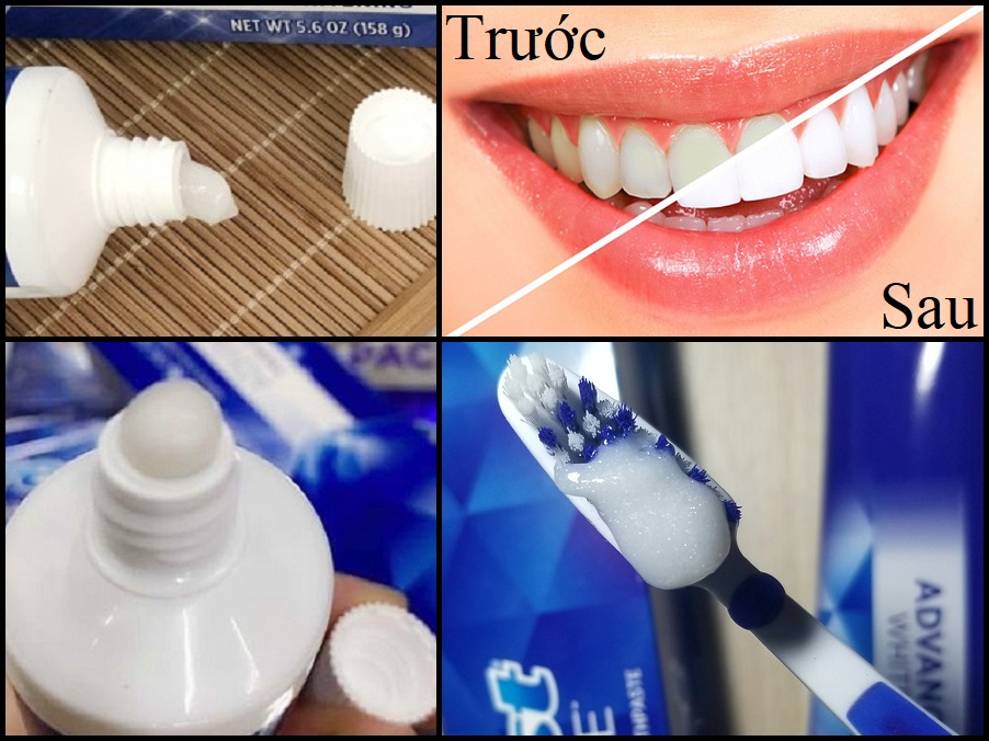 Kem đánh răng Crest 3D White Advanced Whitening 147g (Có Lựa Chọn)