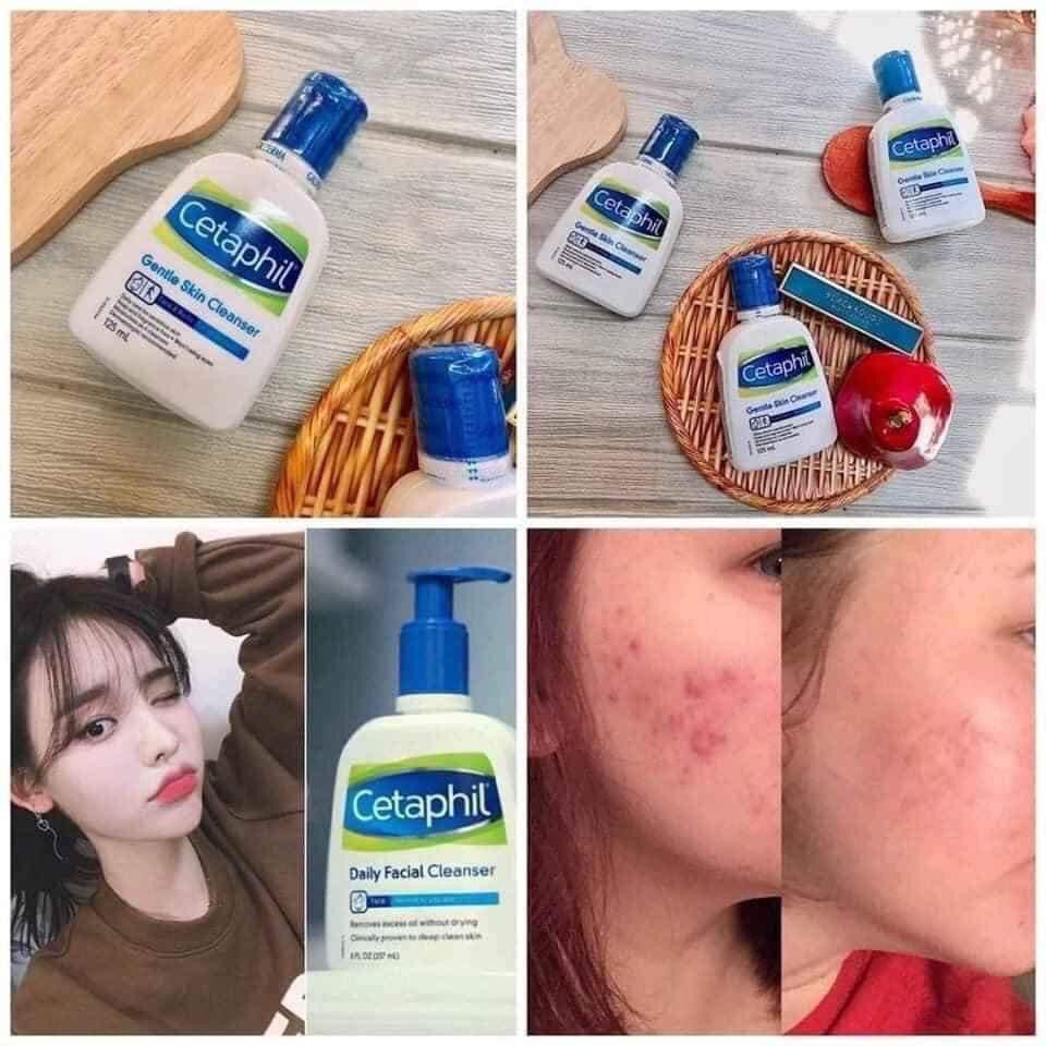 Sữa rửa mặt dịu Cetaphil Gentle Cleanser