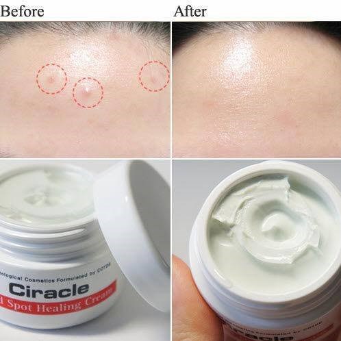 Kem Mụn Ciracle Red Spot Healing Cream 30ml