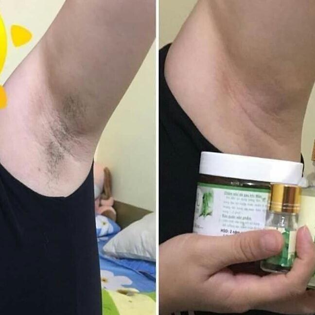 [HCM]wax lông tay chân nách An Lành