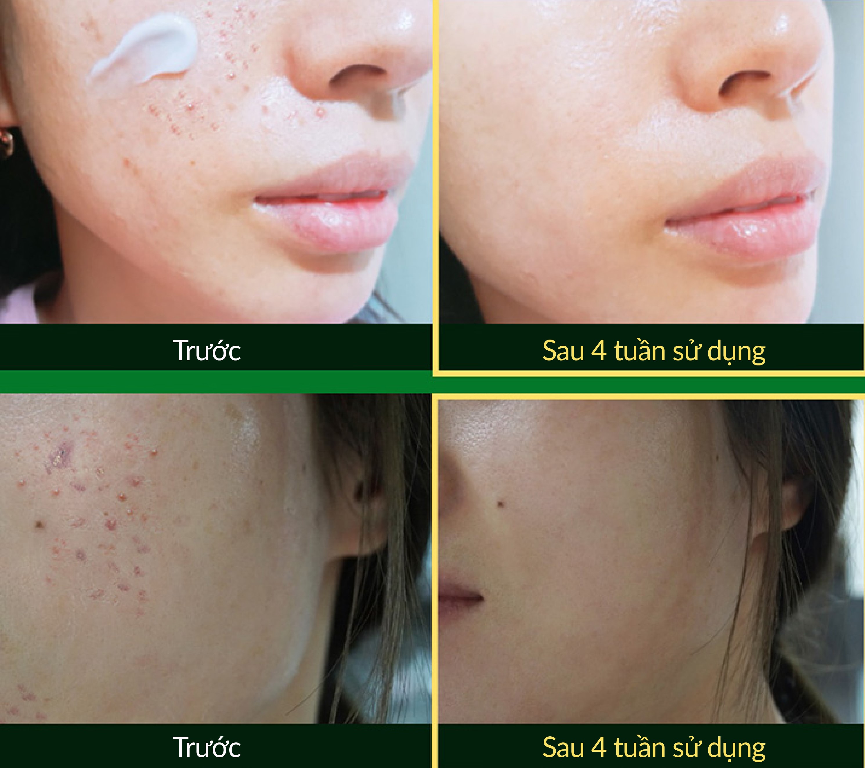 [QUÀ TẶNG] Sample dưỡng da W.SKIN LABORATORY