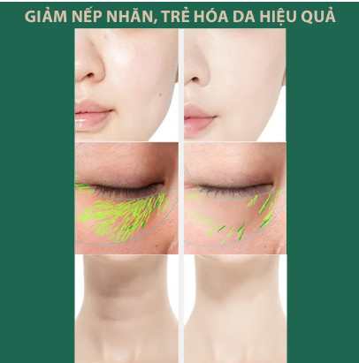 Máy mát xa nâng cơ mặt