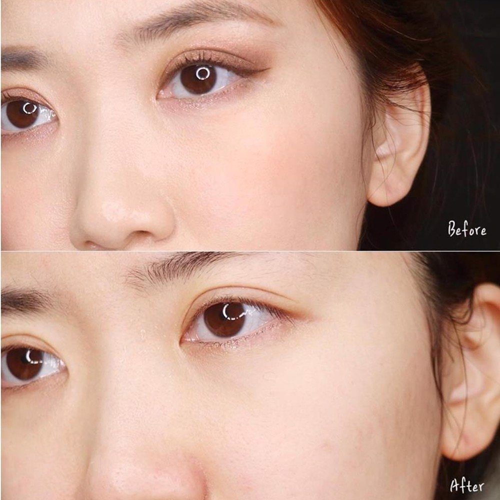 Nước Tẩy Trang Cho Da Dầu Mụn Eucerin Pro Solution Acne & Make-Up Cleansing Water