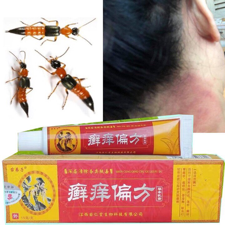Kem bôi da kiến cắn, côn trùng đốt  - hàng có sẵn