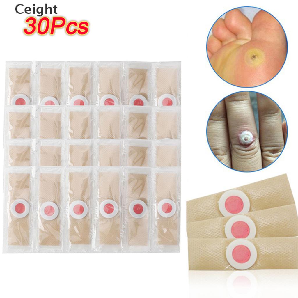 5 Miếng Dán Tẩy Mụt Cóc Nhanh Hiệu Quả Cao