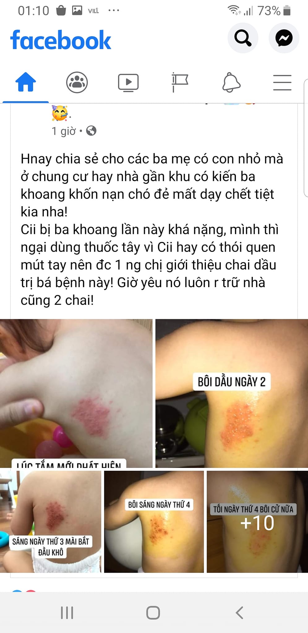 Dầu Phong Hoàn Hảo 50ml