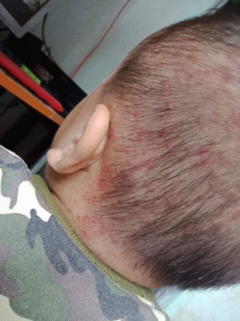 SỮA TẮM LÁ KHỔ QUA RỪNG MẸ KEN