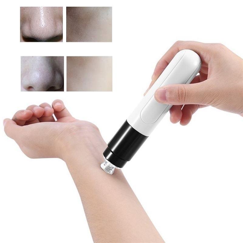Máy hút mụn đầu đen mini cầm tay - chăm sóc da mặt