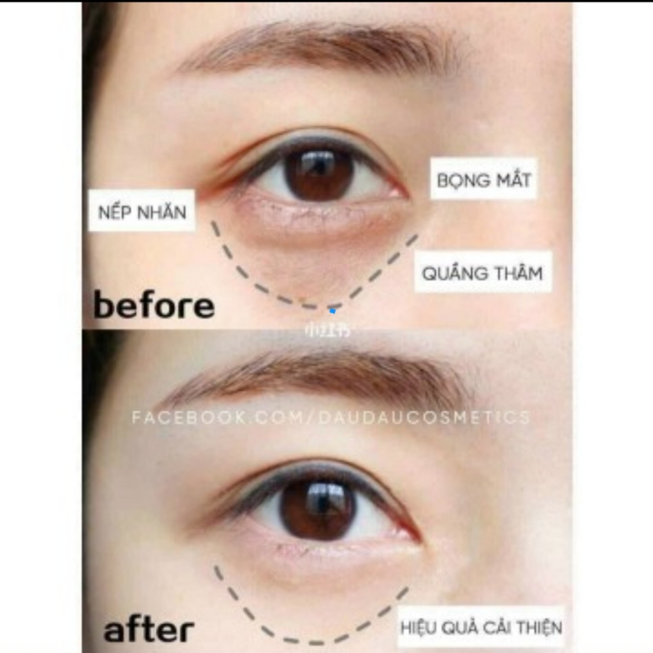 [HCM]KEM MẮT SK II THẦN THÁNH 15g