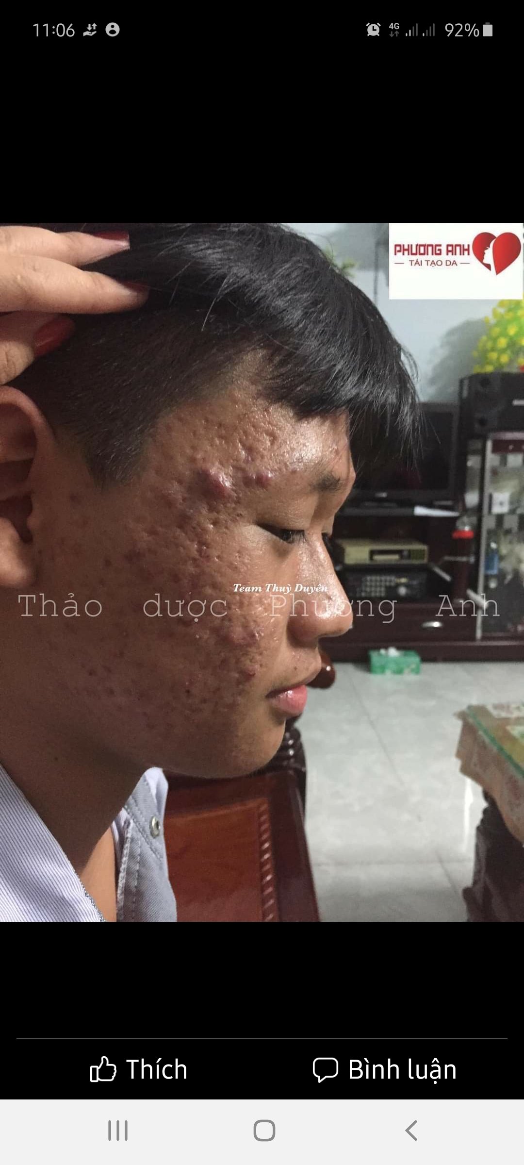 Bột Thảo Dược Rữa Mặt Phương Anh