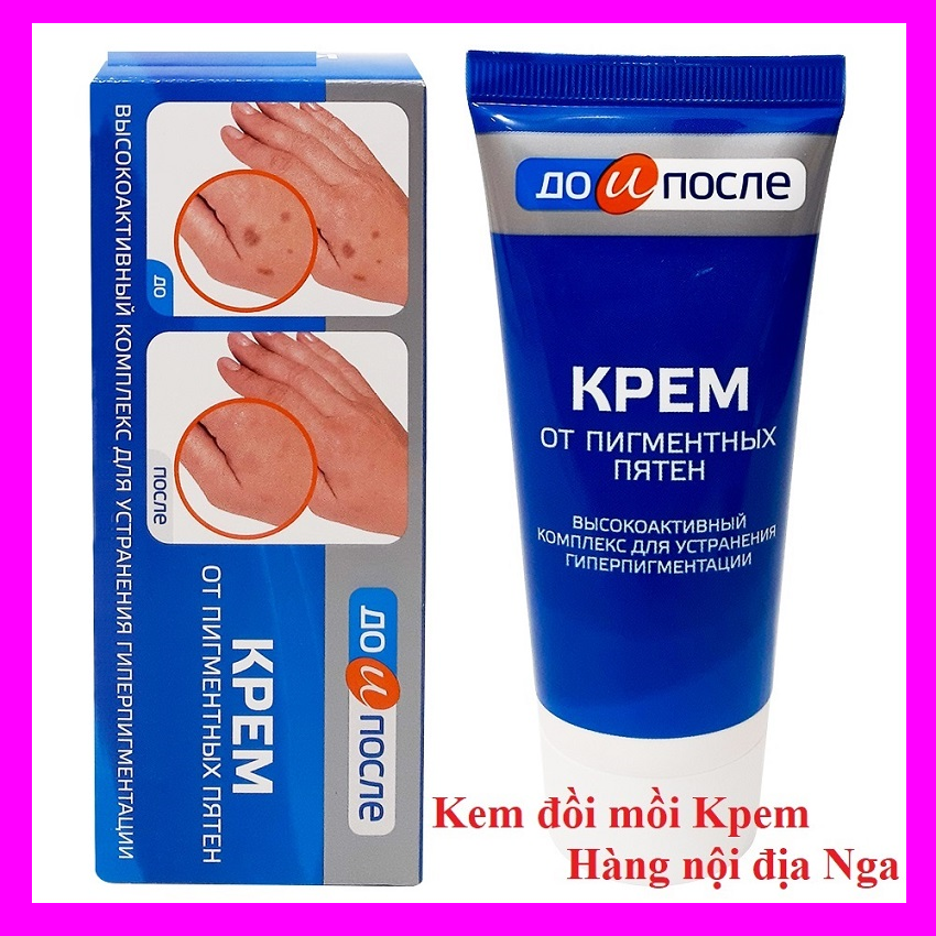 Cream kpem translucent đồi bait, hand lotion Russian, reduce dark circles pigmentation, tortoise, soft leather hand-cream kpem 75ml