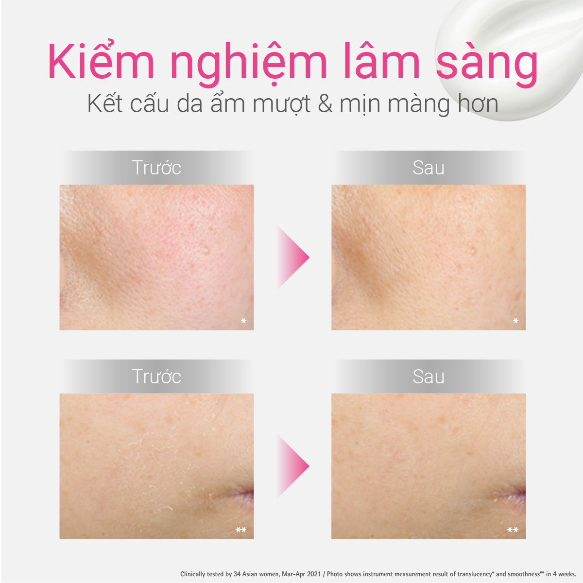 Kem dưỡng ẩm và phục hồi da d Program Skin Repair Cream 45g