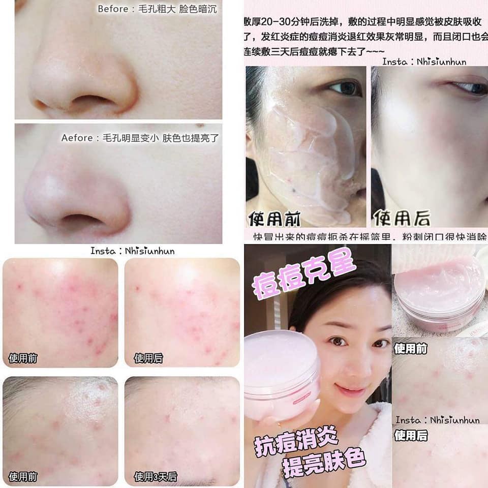 Mặt nạ rửa Loveisderma minisize các loại.