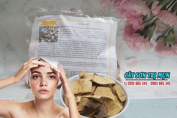 Cây sơn bôi mụn khô 1kg loại 1- dược liệu thanh bình