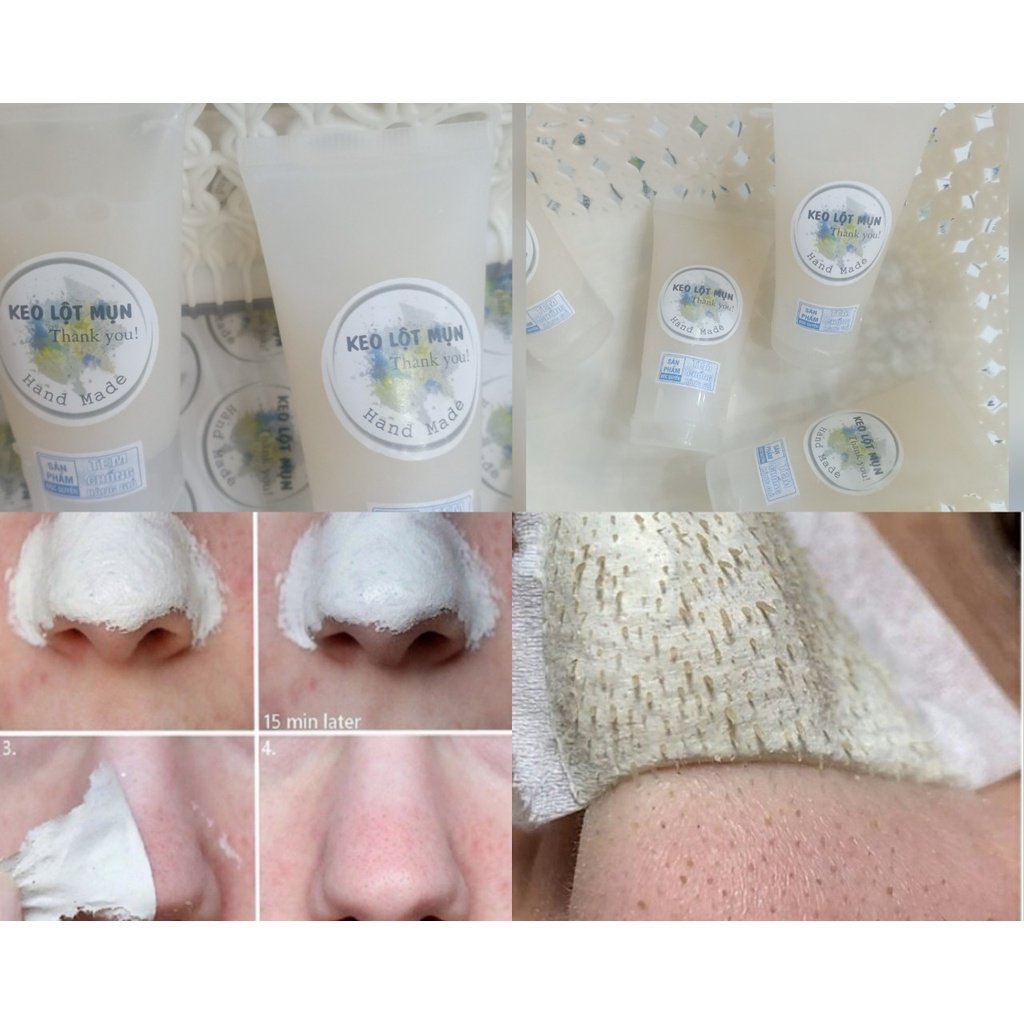 [Ảnh thật] Gel lột mụn hàng Hanmade