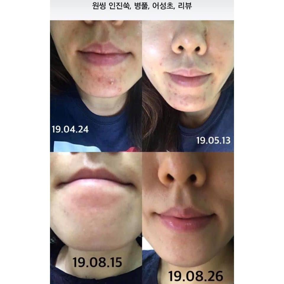 [GOM ORDER 300ML] TONER ONE THING