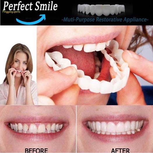 Răng Giả Snap On Smile Kmdeal