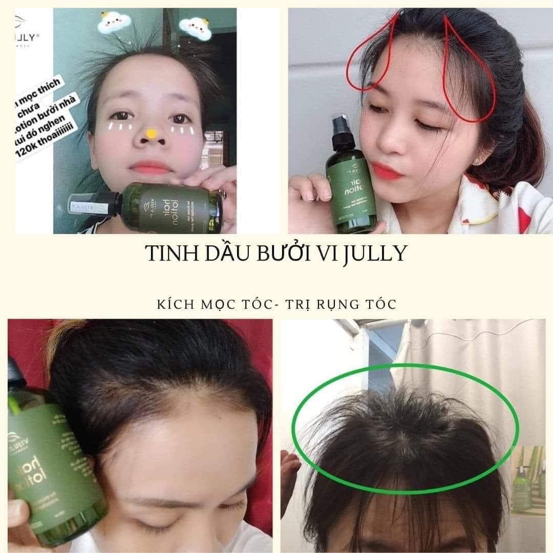 [ Vi Jully ] Combo 5 Chai Tinh Dầu Bưởi Vi Jully Kích Mọc Tóc - Làm Dài Tóc Nhanh