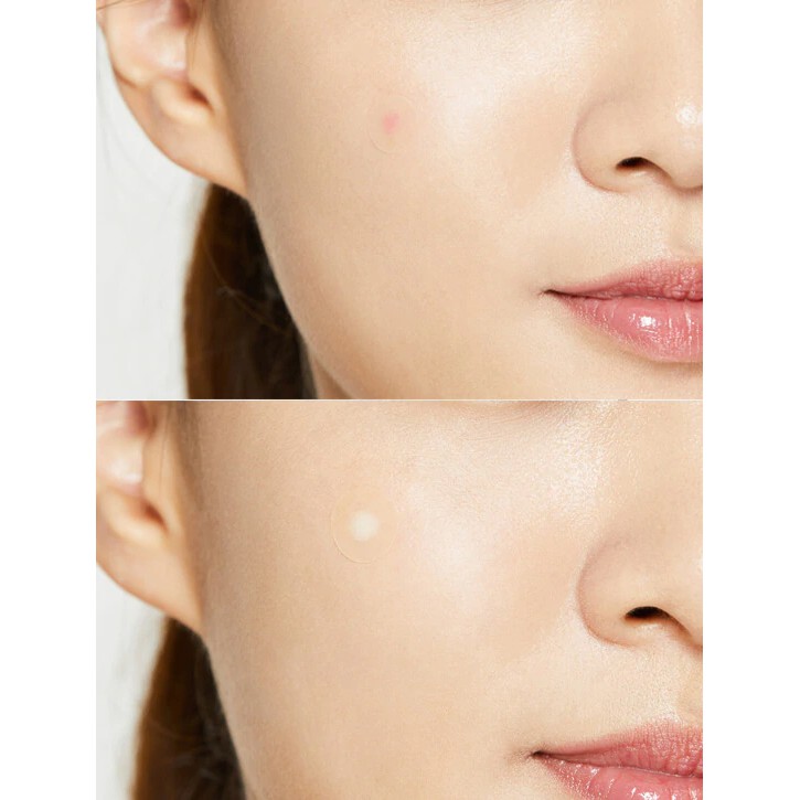 Miếng dán mụn Cosrx Acne Pimple Master Patch (Đỏ) / Cosrx Clear Fit Master Patch (Đen) / Cosrx AC Collection Acne