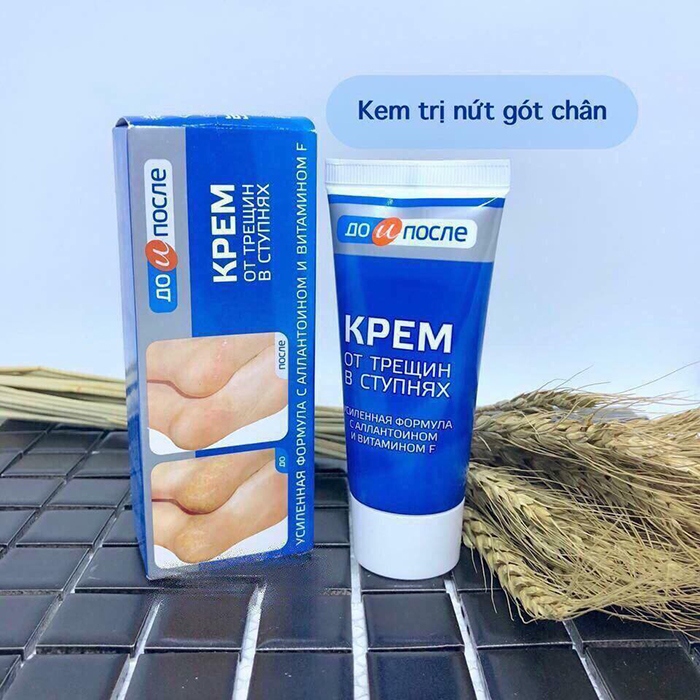 Kem dưỡng gót chân mềm mịn, chống nẻ