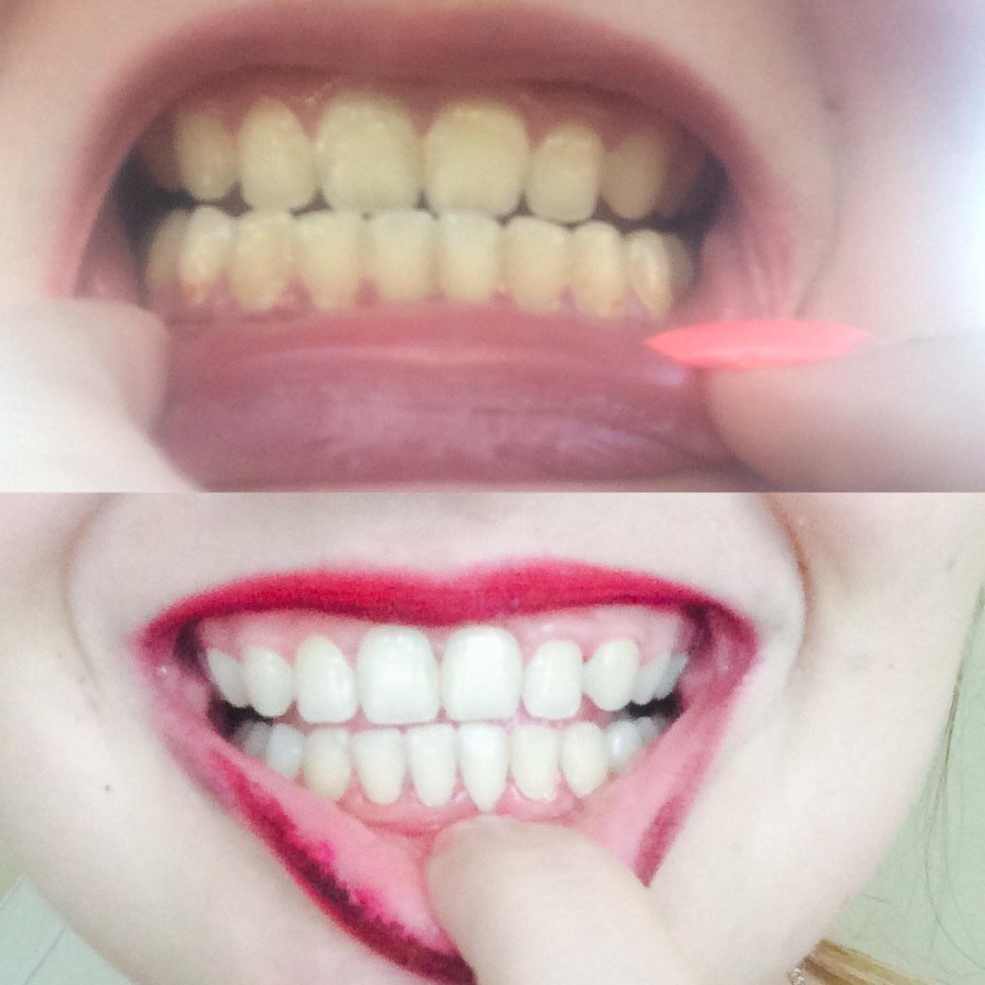 Kem đánh răng Colgate Optic white Renewal 116g
