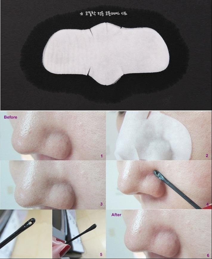Miếng Đẩy Mụn Đầu Đen Ciracle Goodbye Blackhead Off Cotton Mask 5ml