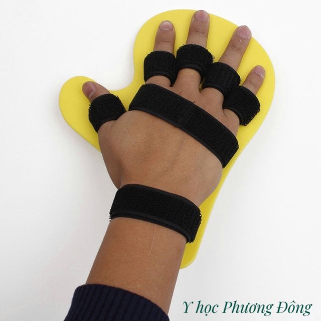 NẸP BÀN TAY PHỤC HỒI CHỨC NĂNG