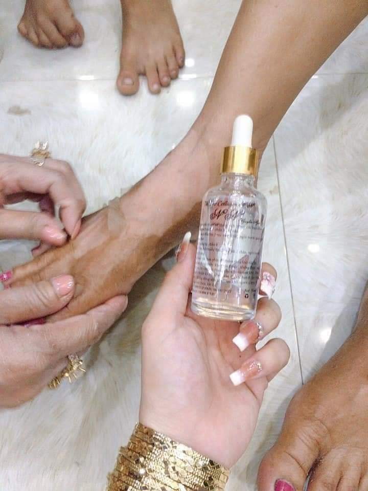 Nước lột NN thay da sinh học 50ml