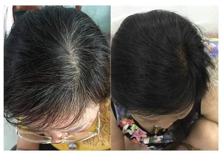 Combo Dầu gội phủ bạc Lich5 + Dầu gội đen tóc hà thủ ô [cặp đôi hoàn hảo cho ng tóc bạc]