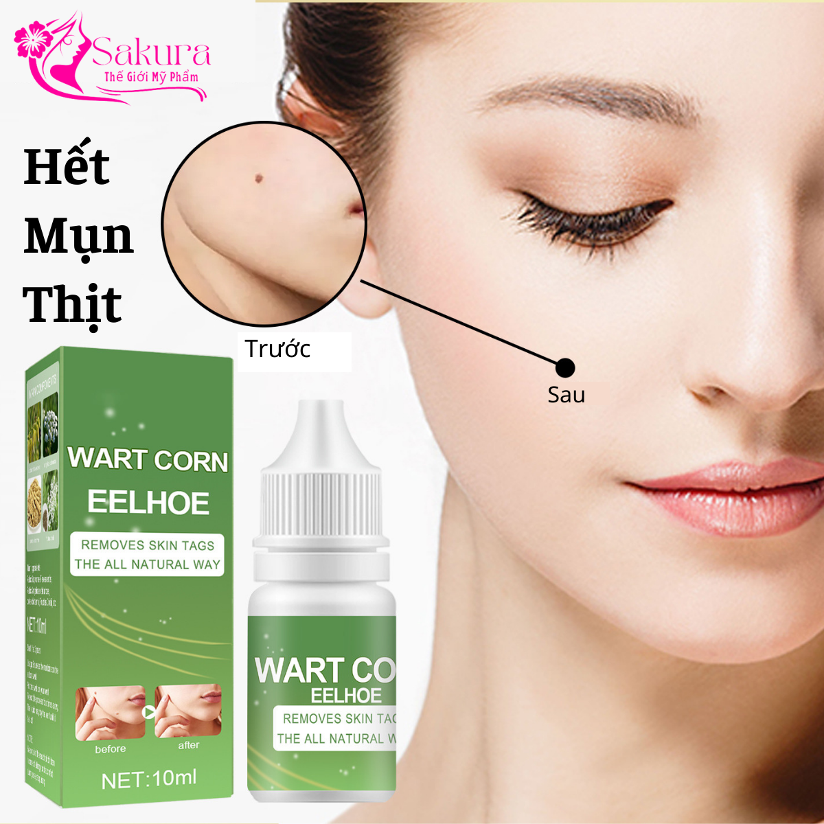 Serum đánh bay mụn thịt mụn ruồi mụn cóc, loại bỏ tận gốc các loại mụn trên cơ thể