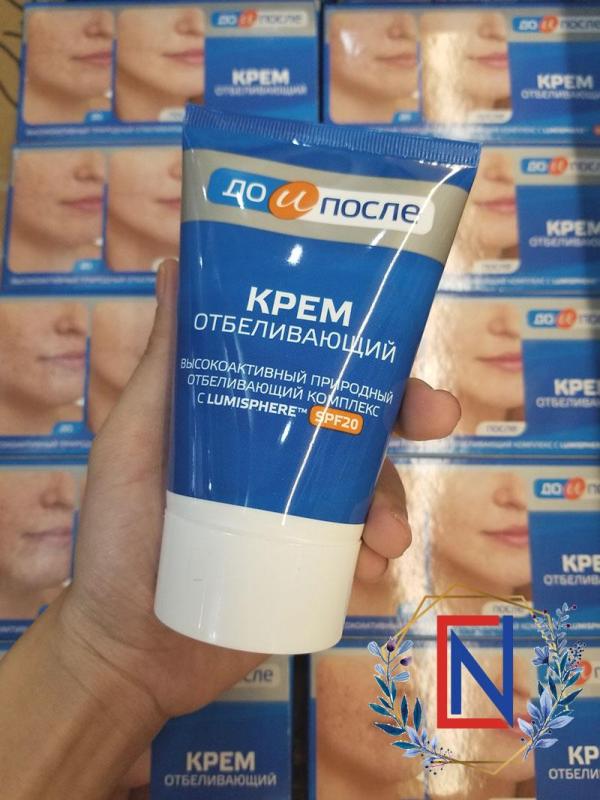 Kem trị nám mặt Kpem