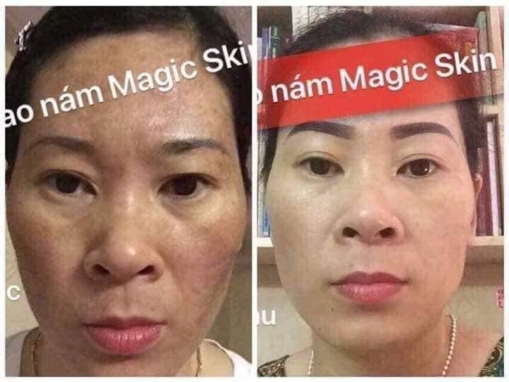KEM CAO NAM SIZE NHO MAGIC SKIN