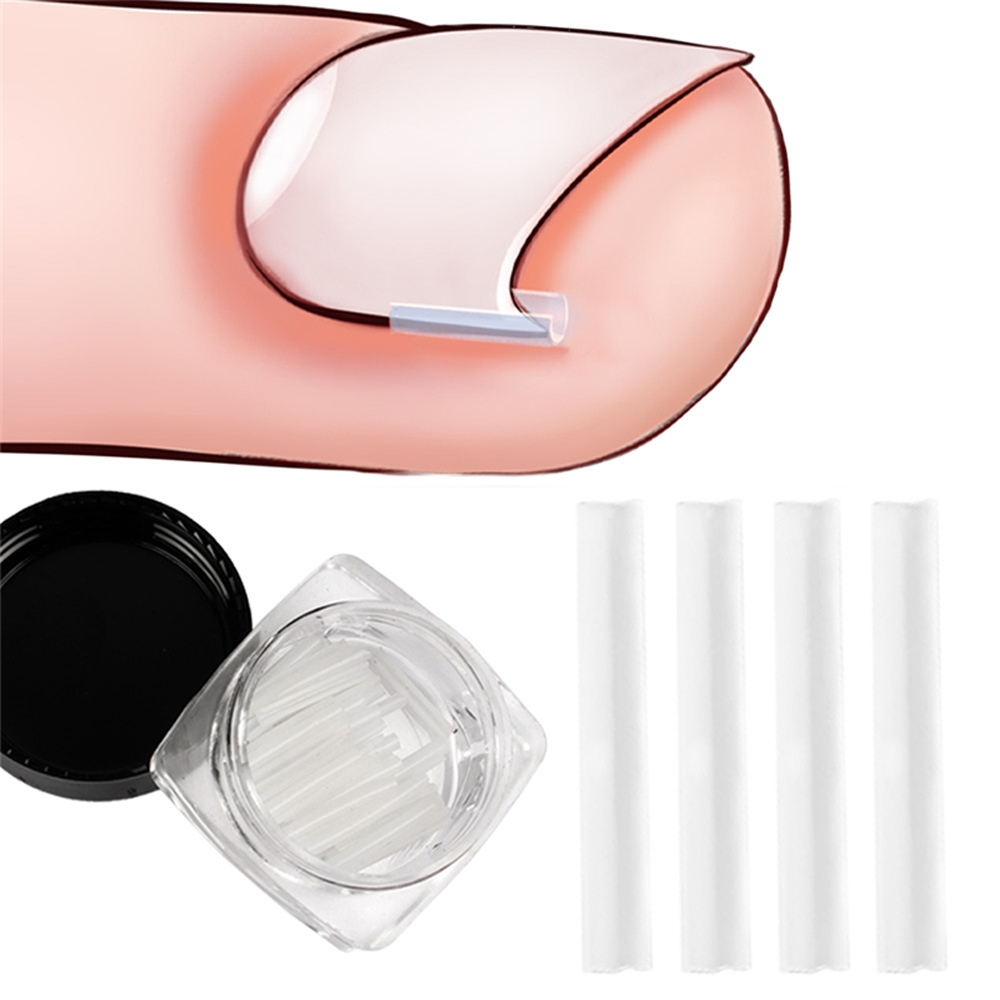 Miếng dán chỉnh hình móng chân mọc ngược WAF2125 - INTL