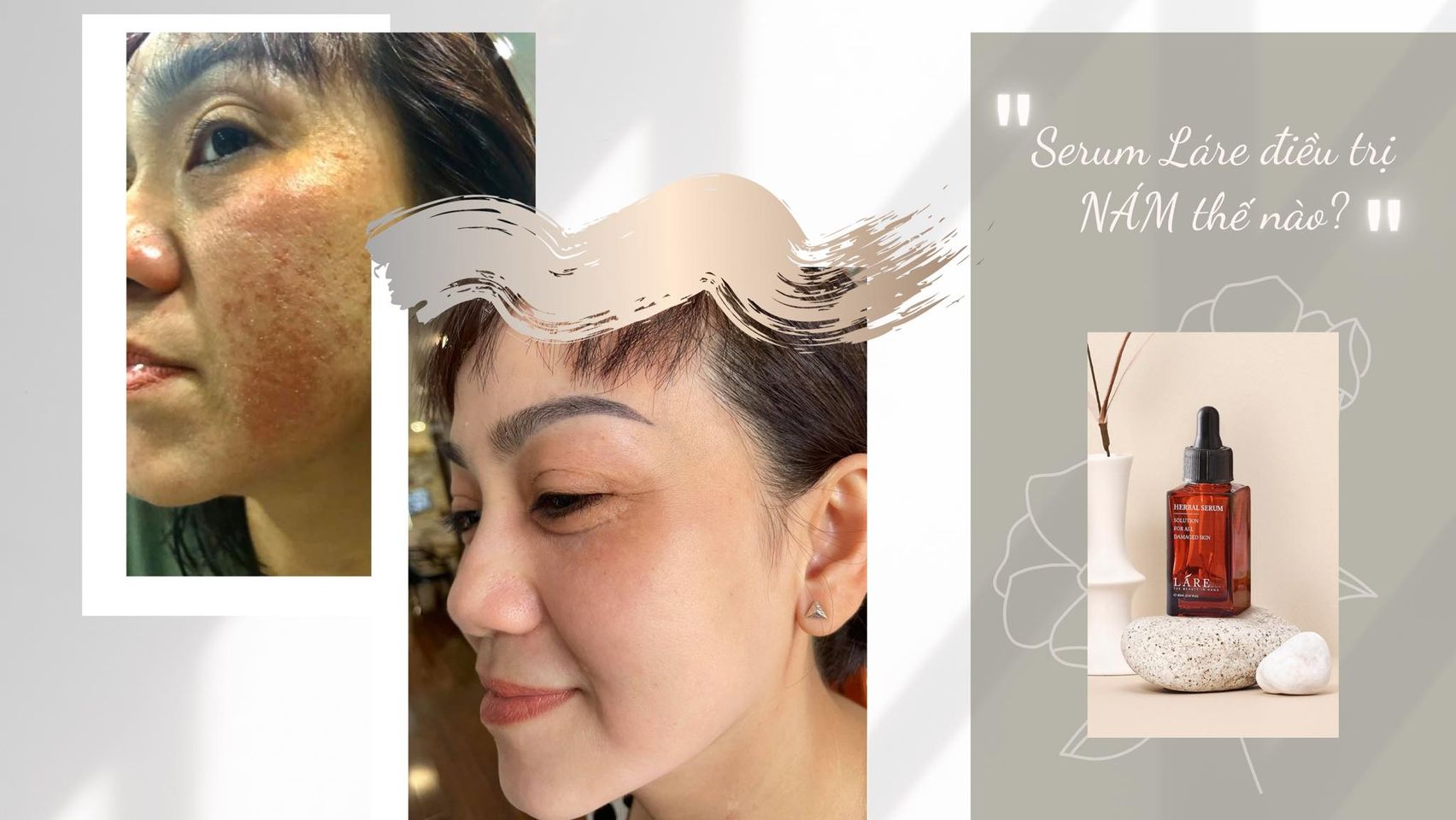 Combo Thanh Dược Lare( serum 50ml+mask trắng da 120gr+srm12gr)