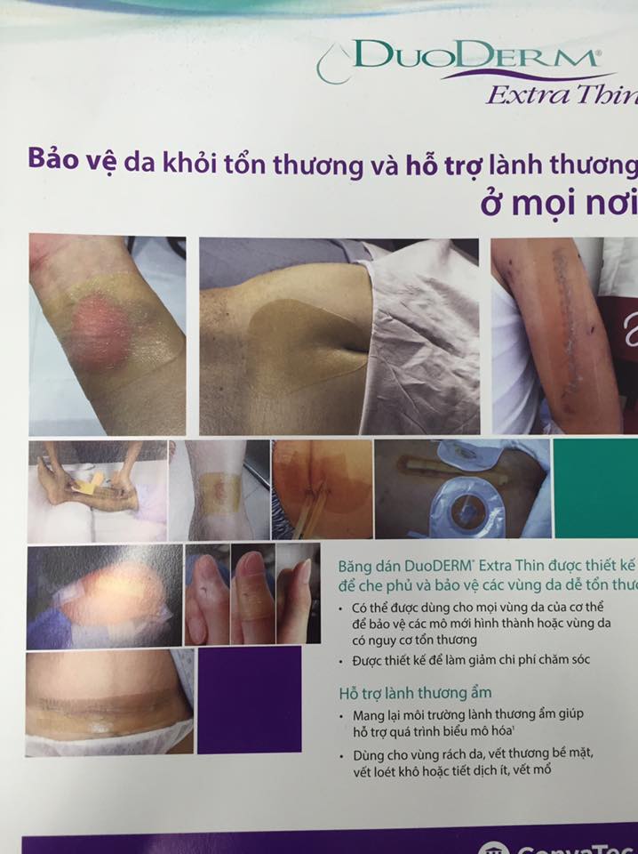 Miếng Dán Hút Mụn, mủ, vết bỏng Duoderm Extra Thin ( DÀNH CHO LƯỢNG DỊCH ÍT )