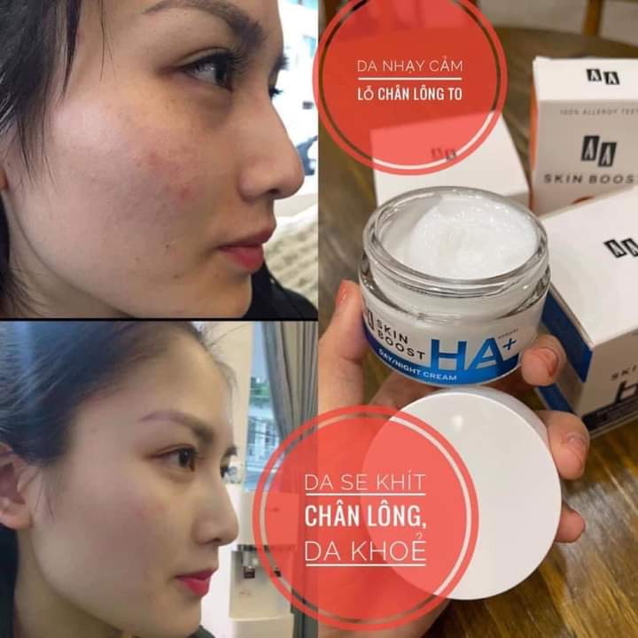 [FREESHIP] Kem Cấp Ẩm Và Làm Mịn Da AA Skin Boost HA + - AA COSMETICS (Mỹ Phẩm Hàng Đầu Châu Âu)