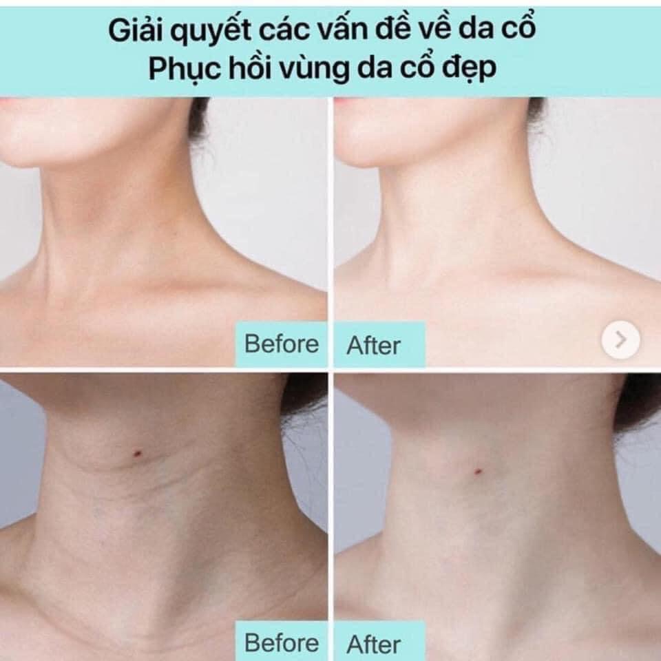 Kem Dưỡng Cổ Medil Peel Nate Thread Neck Cream 100ml