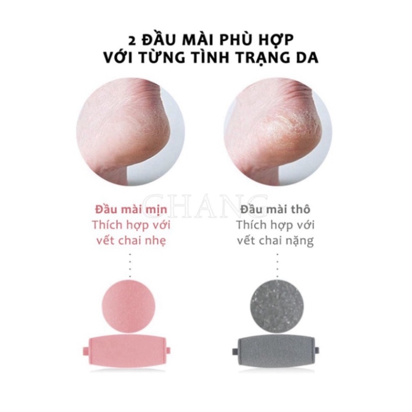 Máy Mài Chà Gót Chân Cầm Tay (Màu Hồng)