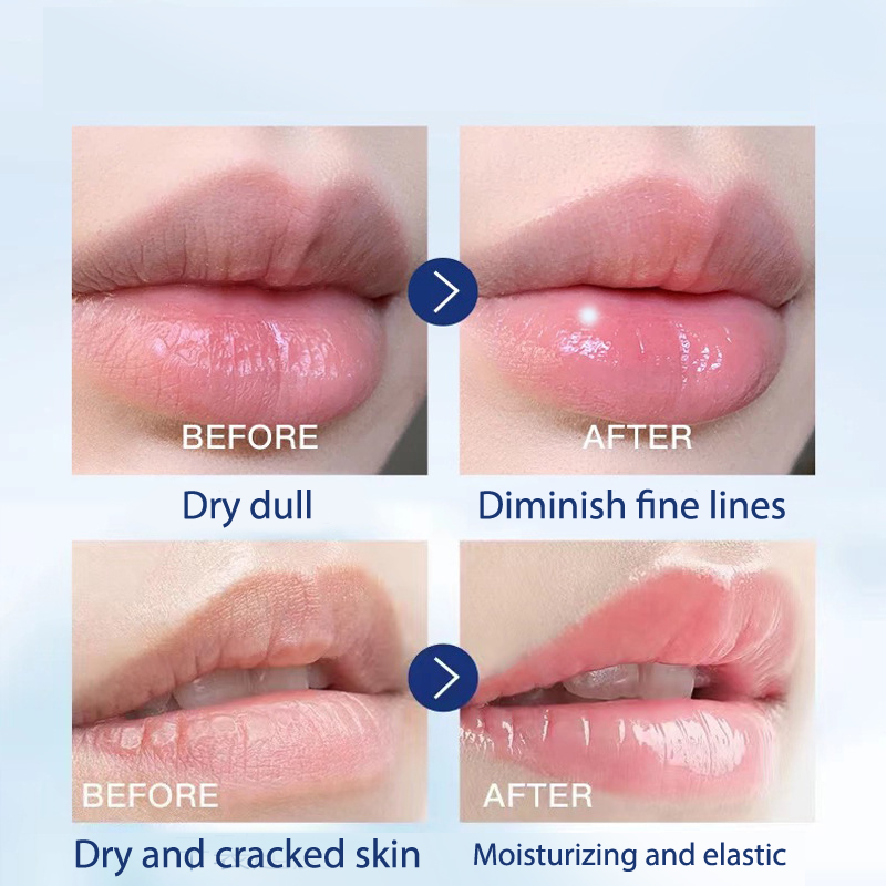 Vaseline Dưỡng Môi 7g Giúp Dưỡng Môi Hồng